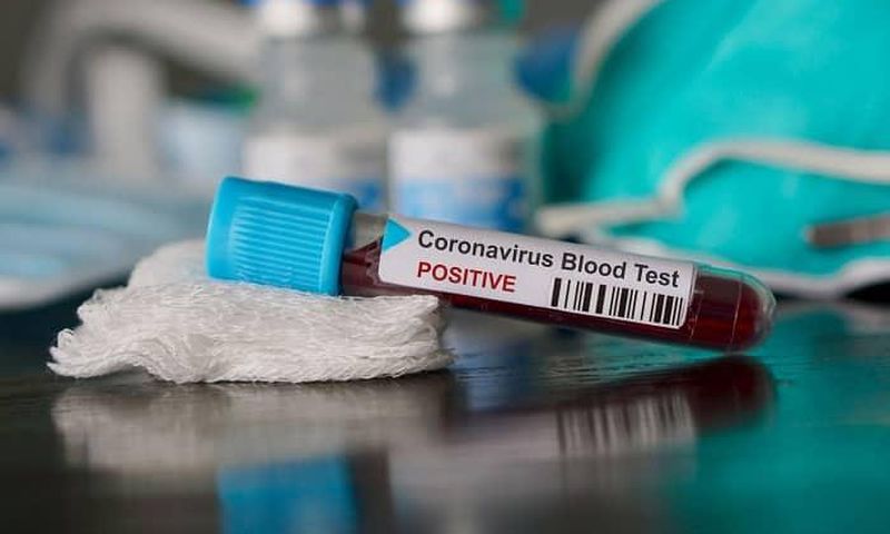 Covid-19 : 132 nouveaux cas dont 17 communautaires, 1 cas importé, 114 guéris, 2263 personnes sous traitement