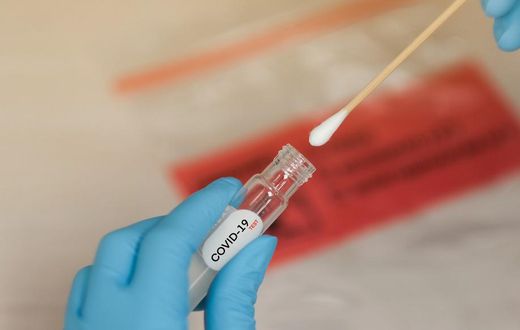 Covid-19, Point du Jour: 45 nouveaux cas dont 10 communautaires, 2 cas importés, 66 guéris, 00 décès...