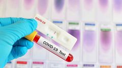 COVID-19 : 2 MORTS ET 42 NOUVELLES CONTAMINATIONS