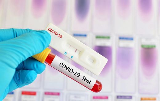 COVID-19 : 2 MORTS ET 42 NOUVELLES CONTAMINATIONS