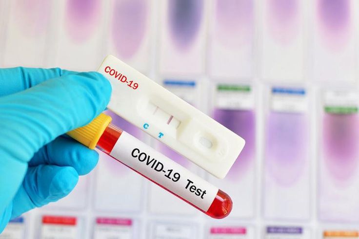 CORONAVIRUS : 64 GUÉRIS CONTRE 39 NOUVEAUX CAS POSITIFS ET UN DÉCÈS