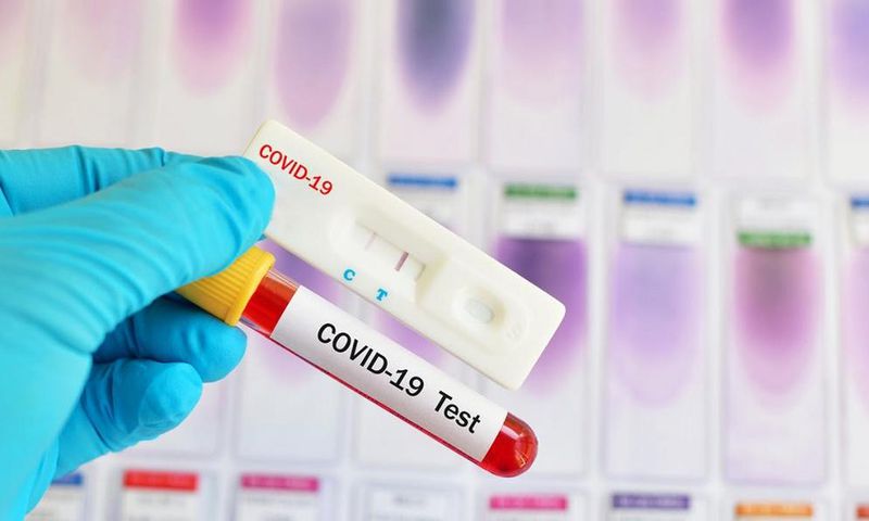 CORONAVIRUS : 64 GUÉRIS CONTRE 39 NOUVEAUX CAS POSITIFS ET UN DÉCÈS