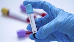 Covid-19 : 124 nouveaux cas dont 15 communautaires, 76 guéris, 18 cas graves, 1702 patients sous traitement