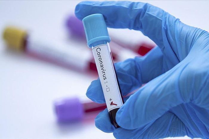 Covid-19 : 124 nouveaux cas dont 15 communautaires, 76 guéris, 18 cas graves, 1702 patients sous traitement