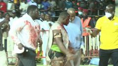 Papa Sow grièvement blessé