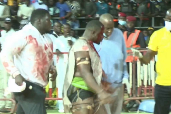 Papa Sow grièvement blessé