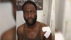 Kilifeu-blesse-à-l'epaule