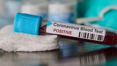 COVID-19 : 127 NOUVEAUX CAS, 2 DÉCÈS, 36 PATIENTS EN RÉANIMATION