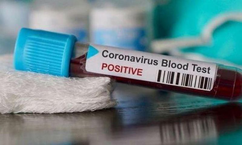 COVID-19 : 127 NOUVEAUX CAS, 2 DÉCÈS, 36 PATIENTS EN RÉANIMATION