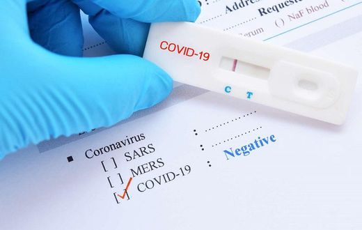 Test coronavirus negatif