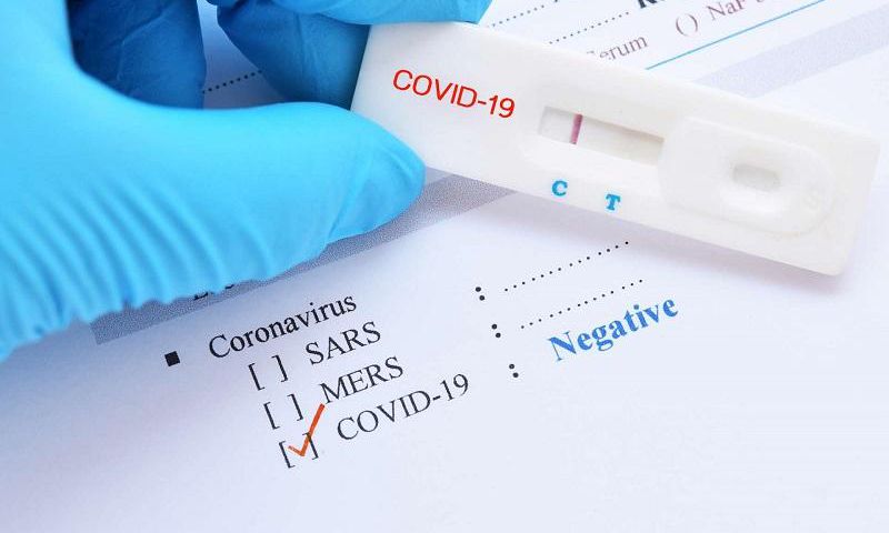 Test coronavirus negatif