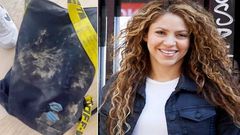 Shakira attaquée par des sangliers