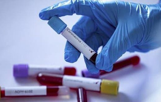 Covid-19 : 59 nouveaux cas dont 7 communautaires, 49 guéris, 7 cas graves, 926 personnes sous traitement