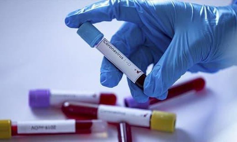 Covid-19 : 92 nouveaux cas dont 18 communautaires, 106 guéris, 23 cas graves, 1694 patients sous traitement
