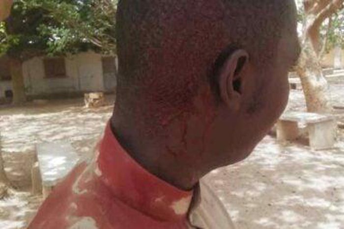 Prof d'anglais blessé par une brique landé par un élève