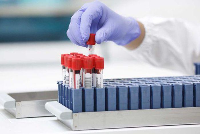 Covid-19 : 141 nouveaux cas dont 83 communautaires, 2 décès, 43 cas graves...