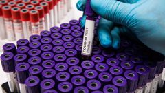 COVID-19 : 136 NOUVELLES CONTAMINATIONS, 3 DÉCÈS RAPPORTÉS CE MERCREDI