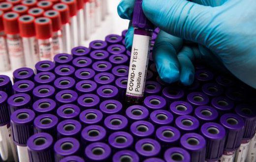 COVID-19 : 136 NOUVELLES CONTAMINATIONS, 3 DÉCÈS RAPPORTÉS CE MERCREDI