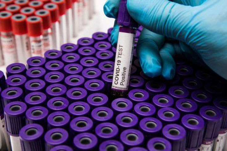 COVID-19 : 136 NOUVELLES CONTAMINATIONS, 3 DÉCÈS RAPPORTÉS CE MERCREDI