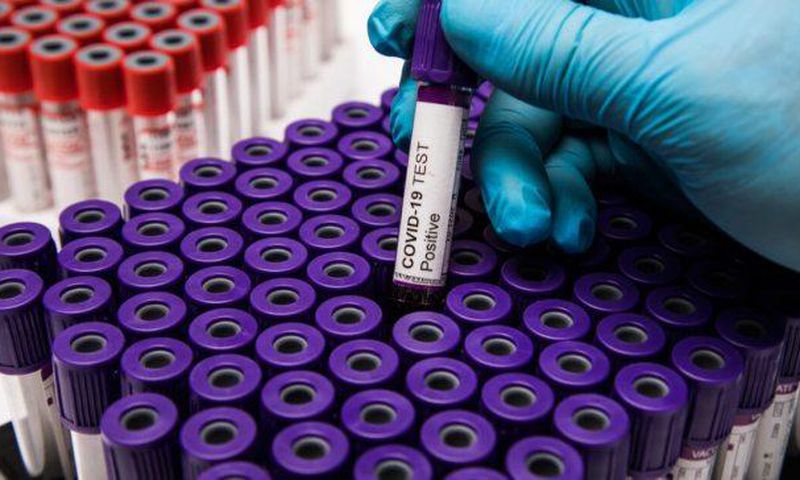 COVID-19 : 136 NOUVELLES CONTAMINATIONS, 3 DÉCÈS RAPPORTÉS CE MERCREDI