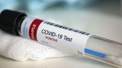 Covid-19 : 108 nouveaux cas dont 49 communautaires, 2 décès, 43 cas graves....