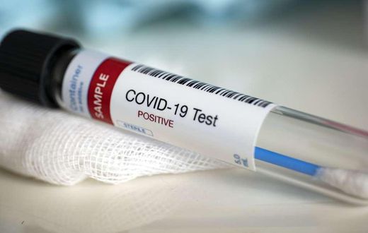 Covid-19 : 108 nouveaux cas dont 49 communautaires, 2 décès, 43 cas graves....