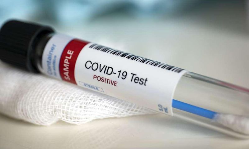 Covid-19 : 108 nouveaux cas dont 49 communautaires, 2 décès, 43 cas graves....