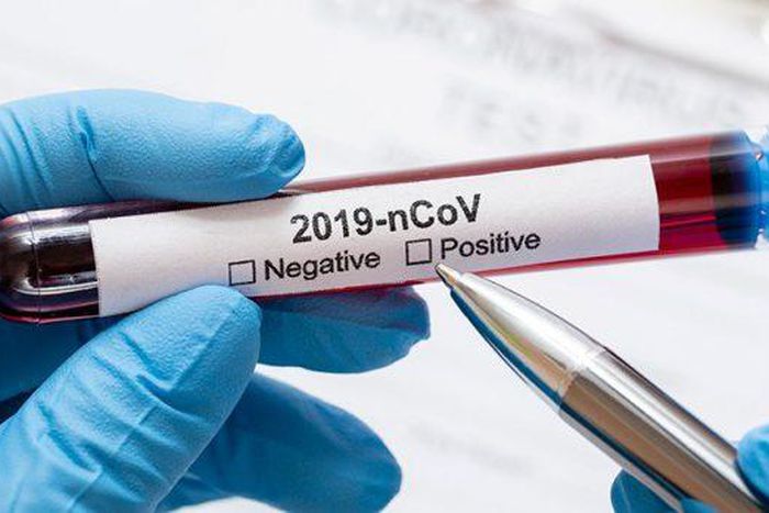 Covid-19 : 30 nouveaux cas dont 11 communautaires,1 décès, 36 cas graves....