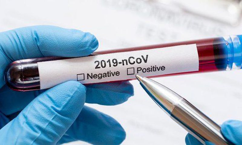 COVID-19 : UN TAUX DE POSITIVITÉ À 1%, 5 FOIS PLUS DE GUÉRIS QUE DE CAS POSITIFS