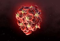 05ab19aac0 50159244 thrombus-plaquette-sang-thrombocytemie-essentielle