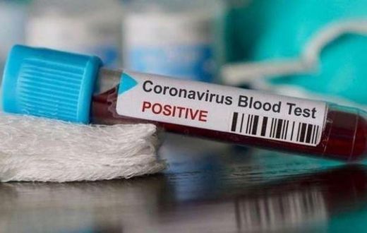 COVID-19 : 130 NOUVEAUX CAS, 137 GUÉRIS ET 49 PATIENTS EN RÉA