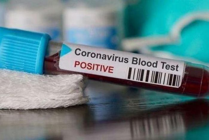 COVID-19 : 130 NOUVEAUX CAS, 137 GUÉRIS ET 49 PATIENTS EN RÉA