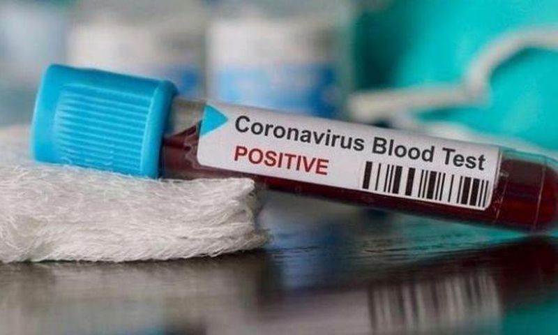 COVID-19 : 130 NOUVEAUX CAS, 137 GUÉRIS ET 49 PATIENTS EN RÉA