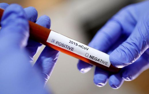 COVID-19 : 5 DÉCÈS ENREGISTRÉS ET 177 NOUVEAUX CAS