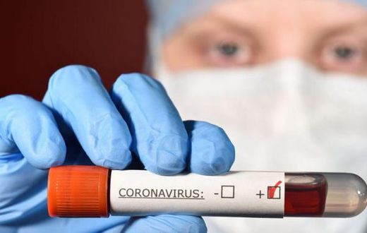 COVID-19 : LES CAS COMMUNAUTAIRES PERSISTENT, 1 DÉCÈS ENREGISTRÉ