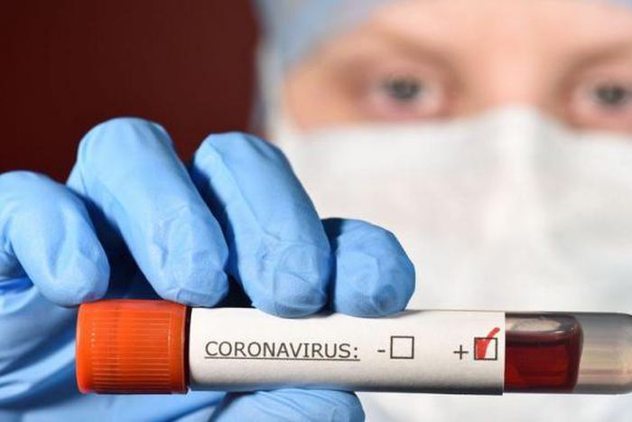 COVID-19 : LES CAS COMMUNAUTAIRES PERSISTENT, 1 DÉCÈS ENREGISTRÉ