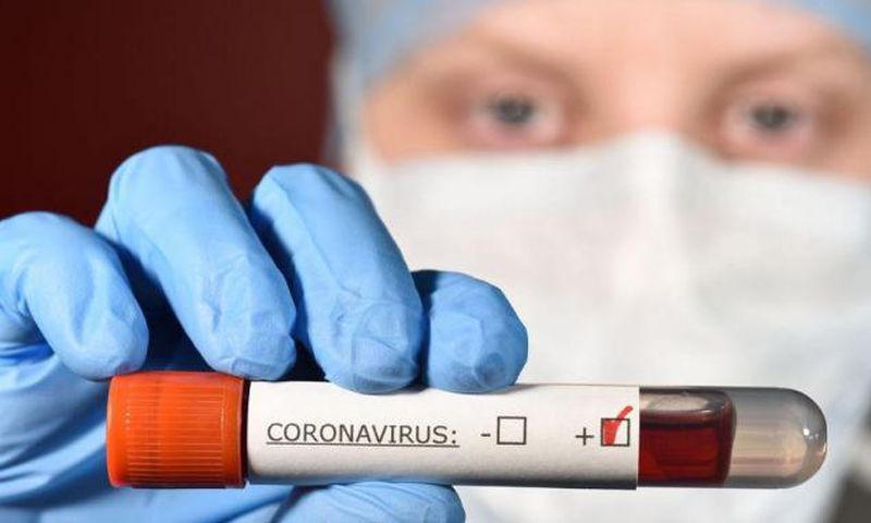 COVID-19 : LES CAS COMMUNAUTAIRES PERSISTENT, 1 DÉCÈS ENREGISTRÉ