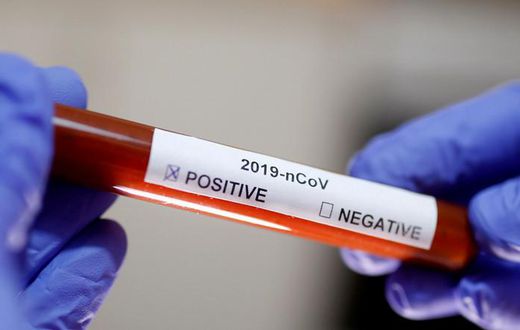Covid-19 : 31 nouveaux cas dont 3 communautaires, 50 guéris, 18 cas graves, 1559 patients sous traitement