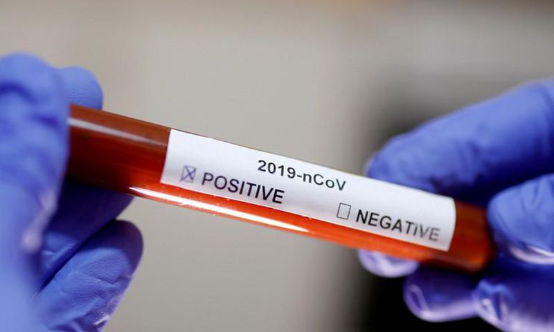 Covid-19 : 31 nouveaux cas dont 3 communautaires, 50 guéris, 18 cas graves, 1559 patients sous traitement