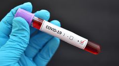 COVID-19 : 98 NOUVEAUX POSITIFS, 2 DÉCÈS, LA BARRE DES 5000 GUÉRIS DÉPASSÉE
