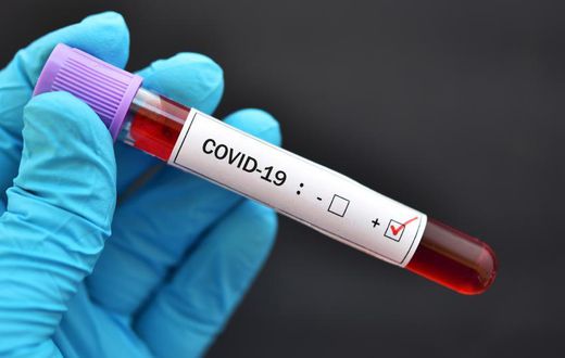 COVID-19 : 98 NOUVEAUX POSITIFS, 2 DÉCÈS, LA BARRE DES 5000 GUÉRIS DÉPASSÉE