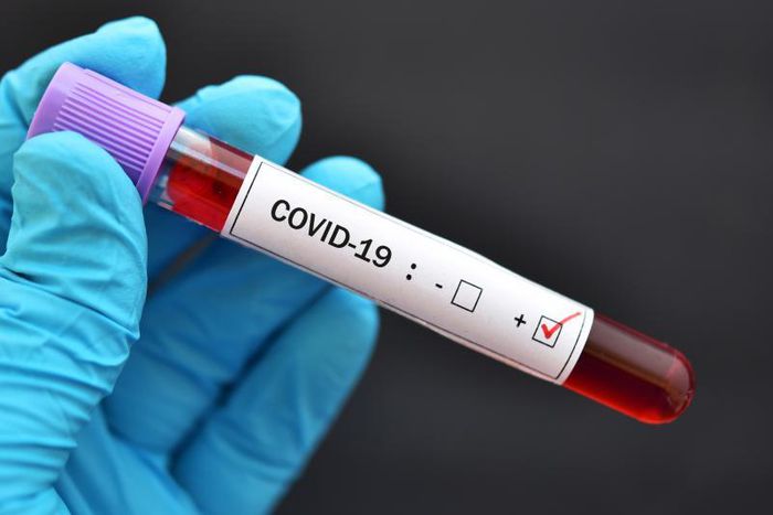 COVID-19 : 98 NOUVEAUX POSITIFS, 2 DÉCÈS, LA BARRE DES 5000 GUÉRIS DÉPASSÉE