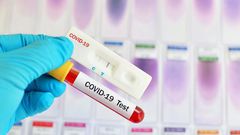 Covid-19 : 64 nouveaux cas dont 28 communautaires, 3 décès, 45 cas graves...