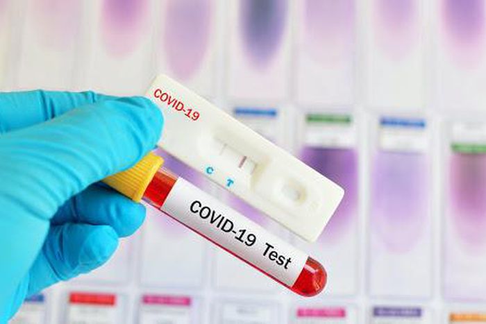 Covid-19 : 64 nouveaux cas dont 28 communautaires, 3 décès, 45 cas graves...