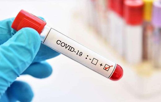 Covid-19 : 68 nouveaux cas dont 25 communautaires, 2 cas importés, 48 cas graves...