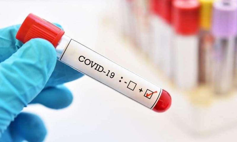 Covid-19 : 68 nouveaux cas dont 25 communautaires, 2 cas importés, 48 cas graves...