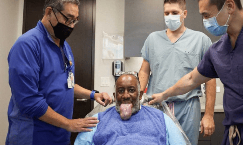 dilatation langue