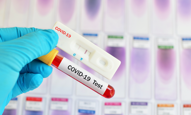 Covid-19 : 110 nouveaux cas dont 23 communautaires, 74 guéris, 4 décès, 2418 personnes sous traitement