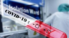 Covid-19 : 63 nouveaux cas dont 25 communautaires, 4 cas importés, 4 décès...