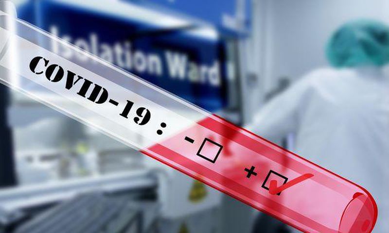 Covid-19 : 63 nouveaux cas dont 25 communautaires, 4 cas importés, 4 décès...